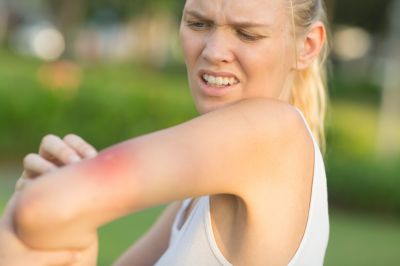 Prevent Allergic Reactions with Stinging Insects' Removal!