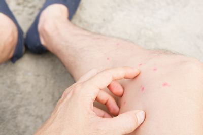 Maintain a Clean and Healthy Home or Business with Flea Pest Control!